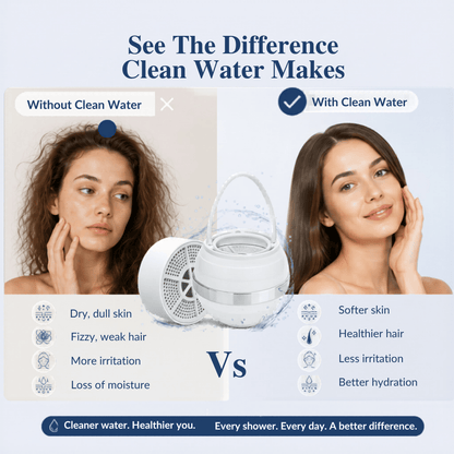 Comparison chart showing skin and hair benefits of cleaner, softer water with the Gentle Bath Filter